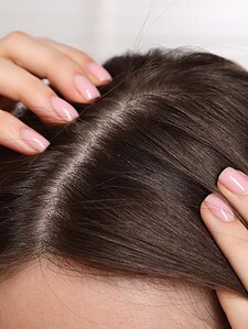 Long-Term Scalp Health